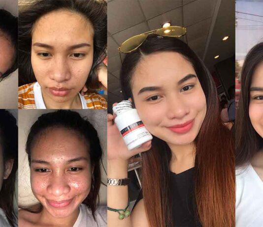 1 IkYRFmRi6kAmzlU3O4AkBA